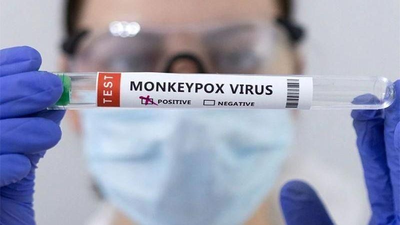 Bệnh đậu mùa khỉ có thể gây tử vong không?
