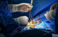 700 ca phẫu thuật tim ít xâm lấn và hành trình làm chủ kỹ thuật mới của các bác sĩ tim nhi
