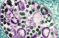 Hình ảnh dưới kính hiển vi điện tử của virus Marburg. (Ảnh: BSIP/UIG/Getty Images)