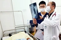 Bệnh nhân được điều trị tại Bệnh viện Bạch Mai.