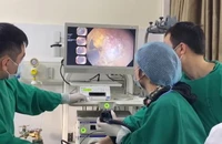 Các bác sĩ Bệnh viện 19-8 nội soi cắt tách dưới niêm mạc điều trị ung thư dạ dày sớm cho bệnh nhân. (Ảnh: cand.com.vn)