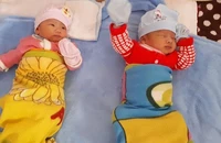 Mặc dù mang gen hemophilia nhưng chị Hoàng Thị Yến có thể sinh hai con không bị bệnh nhờ chẩn đoán trước chuyển phôi. (Ảnh: Nhân vật cung cấp)