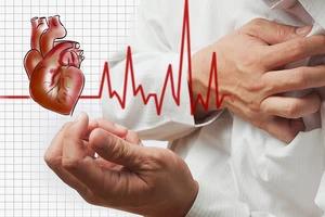 Những triệu chứng báo hiệu có vấn đề về tim mạch hậu Covid-19?