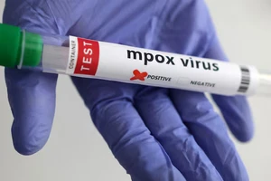 Xét nghiệm virus đậu mùa khỉ. Ảnh: Reuters.