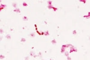 Vi khuẩn Klebsiella oxytoca. Ảnh: PO