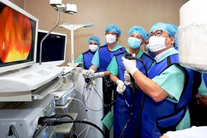 Các bác sĩ ở Bệnh viện Trung ương Huế thực hiện kỹ thuật tán sỏi mật bằng laser qua đường miệng. (Ảnh: Bệnh viện cung cấp)