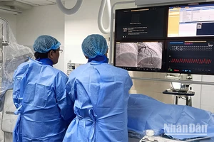 Đơn vị Can thiệp nội mạch thực hiện kỹ thuật nong và đặt stent động mạch vành cho bệnh nhân dưới sự hỗ trợ của các chuyên gia Bệnh viện đại học Y Dược Thành phố Hồ Chí Minh (Ảnh: Bệnh viện Đa khoa Đồng Tháp cung cấp).