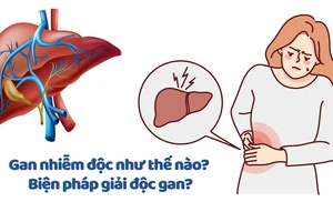 Gan nhiễm độc như thế nào? Biện pháp giải độc gan?