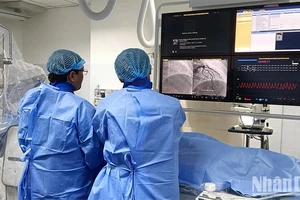Đơn vị Can thiệp nội mạch của Bệnh viện đa khoa Đồng Tháp thực hiện kỹ thuật nong và đặt stent động mạch vành cho bệnh nhân dưới sự hỗ trợ của các chuyên gia Bệnh viện đại học Y Dược Thành phố Hồ Chí Minh (Ảnh: Bệnh viện cung cấp).