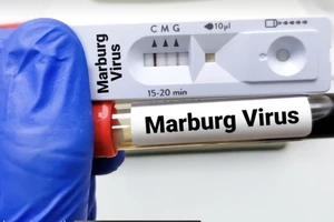 Ống xét nghiệm virus Marburg. Ảnh: Tân Hoa xã