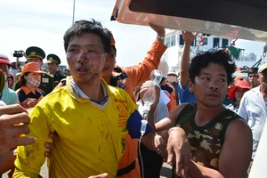 Nạn nhân được cứu sau vụ nổ bình gas trên biển Vũng Tàu tám tháng trước.