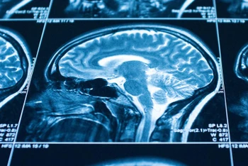 Nghiên cứu mới về não bộ cho thấy tại sao việc tuân theo mệnh lệnh có thể khiến con người làm được những điều khủng khiếp.