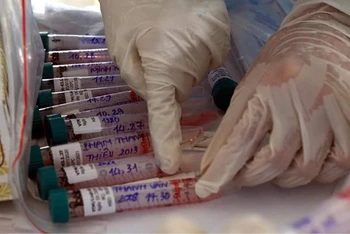 13 bệnh viện được phân tuyến điều trị và xét nghiệm sàng lọc SARS-CoV-2 tại Hà Nội