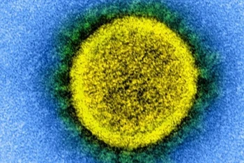Sự lây truyền của virus SARS-CoV-2. Ảnh: NIH.
