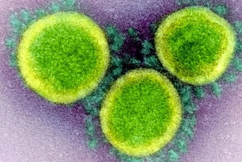 Hình ảnh các hạt virus SARS-CoV-2 qua kính hiển vi điện tử. Ảnh: NIAID.