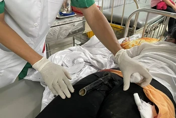 Nữ bệnh nhân N.T.Y.N. nhập viện cấp cứu với chân chống xe máy đâm dính vào mông.