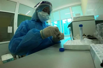 Xét nghiệm mẫu phẩm tại Trung tâm phòng chống bệnh tỉnh Điện Biên.