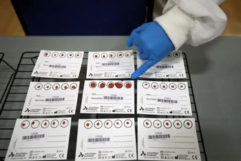 Các mẫu máu trong một thử nghiệm lâm sàng về các xét nghiệm đối với kháng thể Covid-19, tại Đại học Keele, ở Keele, Anh vào ngày 30/6/2020. Ảnh: Reuters.