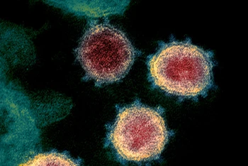 Hình ảnh virus SARS-CoV-2 qua kính hiển vi điện tử. (Ảnh: Reuters)