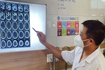 TS,BS Nguyễn Trung Nguyên chỉ ra các dấu hiệu tổn thương não của bệnh nhân sau khi uống rượu chứa cồn công nghiệp methanol.