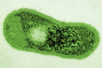 Hình ảnh vi khuẩn Gemmatimonas phototrophica qua kính hiển vi. Ảnh: Jason Dean, Viện Hàn lâm Khoa học Séc.