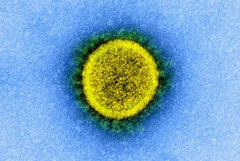 Virus SARS-CoV-2 qua kính hiển vi điện tử. Nguồn: NIH.