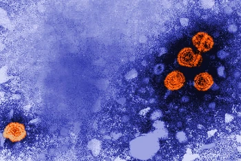 Hình ảnh dưới kính hiển vi của virus viêm gan B, được biểu thị bằng màu cam. (Ảnh: CDC Mỹ)