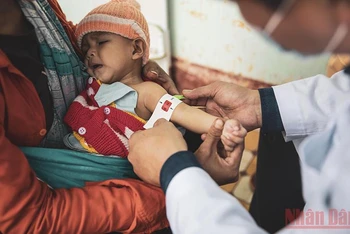 UNICEF kêu gọi cần đẩy mạnh nỗ lực đưa việc điều trị trẻ em suy dinh dưỡng cấp tính vào luật Việt Nam. (Ảnh: UNICEF)