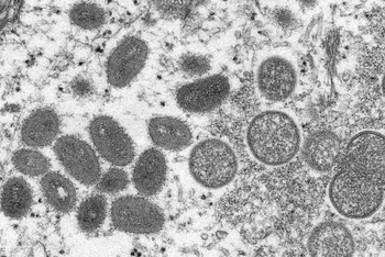 Hình ảnh dưới kính hiển vi cho thấy virus đậu mùa khỉ trong mẫu bệnh phẩm của một bệnh nhân. (Ảnh: Reuters/TTXVN)