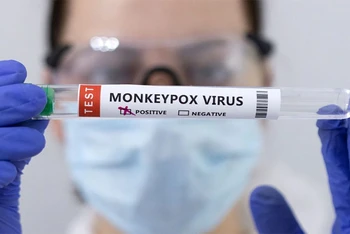 Ống đựng mẫu bệnh phẩm được đánh dấu dương tính với virus gây bệnh đậu mùa khỉ. (Ảnh: Reuters)