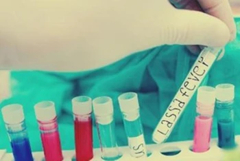 155 người tử vong do dịch sốt Lassa ở Nigeria