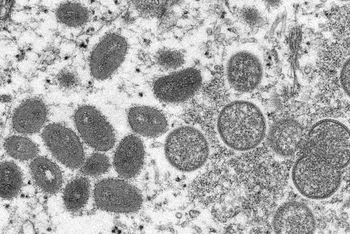 Hình ảnh virus đậu mùa khỉ trưởng thành (hình bầu dục) và chưa trưởng thành (hình cầu) dưới kính hiển vi. (Ảnh: CDC/REUTERS)