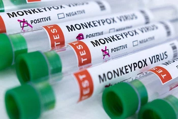 Ống đựng mẫu bệnh phẩm dương tính với virus gây bệnh đậu mùa khỉ. (Ảnh: Reuters)