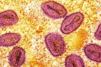 Virus đậu mùa khỉ (màu hồng) dưới kính hiển vi. Ảnh: Reuters.