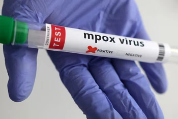 Xét nghiệm virus đậu mùa khỉ. Ảnh: Reuters