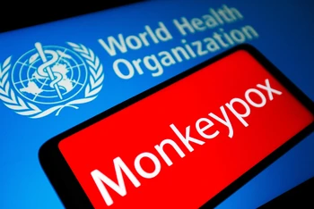 Đến nay, đã có hơn 15 nghìn ca được báo cáo mắc bệnh đậu mùa khỉ ở những nước trước đây không hề phát hiện căn bệnh này. (Ảnh: Getty Images)