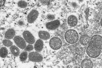 Hình ảnh dưới kính hiển vi cho thấy virus đậu mùa khỉ trong mẫu bệnh phẩm của 1 bệnh nhân. (Ảnh minh họa: Reuters/TTXVN)