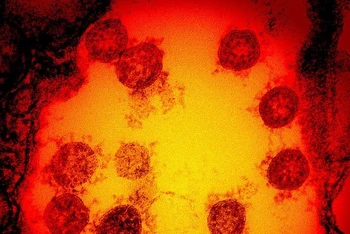 Ảnh vi điện tử được tăng cường màu chụp lại các hạt virus SARS-CoV-2 được phân lập từ mẫu bệnh phẩm của 1 bệnh nhân. (Ảnh: Viện Dị ứng và bệnh truyền nhiễm quốc gia Mỹ)
