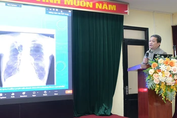Tiến sĩ, bác sĩ cao cấp Đinh Văn Lượng, Giám đốc Bệnh viện Phổi Trung ương chia sẻ về bệnh nấm phổi.
