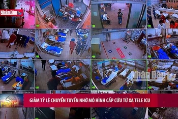 Giảm tỷ lệ chuyển tuyến nhờ mô hình cấp cứu từ xa TELE ICU