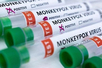 Ống đựng mẫu bệnh phẩm dương tính với đậu mùa khỉ. (Ảnh: Reuters)