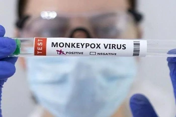 Ống đựng mẫu bệnh phẩm được đánh dấu dương tính với virus gây bệnh đậu mùa khỉ. (Ảnh: Reuters)