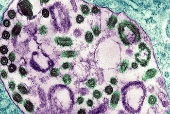 Hình ảnh dưới kính hiển vi điện tử của virus Marburg. (Ảnh: BSIP/UIG/Getty Images)