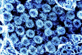 Hình ảnh từ kính hiển vi do Viện nghiên cứu bệnh truyền nhiễm và dị ứng quốc gia Mỹ cung cấp cho thấy virus SARS-CoV-2 trong mẫu bệnh phẩm của bệnh nhân mắc Covid-19. (Ảnh minh họa: AFP/TTXVN)