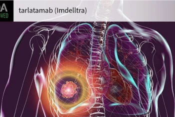 Ảnh: medpagetoday.com/TTXVN.