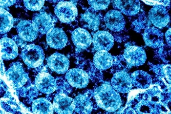 Virus SARS-CoV-2. (Ảnh: AFP/TTXVN)