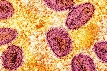 Virus đậu mùa khỉ. (Ảnh: Reuters)