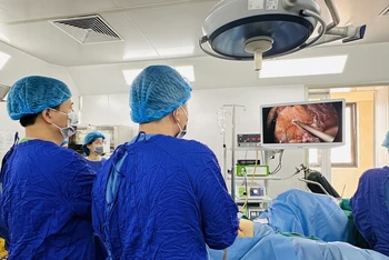 Các bác sĩ Bệnh viện Ung bướu Hà Nội đang thực hiện ca phẫu thuật ứng dụng kỹ thuật NOSE cho bệnh nhân ung thư đại trực tràng di căn