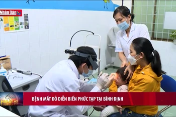 Bệnh mắt đỏ diễn biến phức tạp tại Bình Định