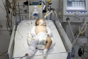 Bé gái đang được điều trị tích cực tại Bệnh viện đa khoa tỉnh Lâm Đồng.